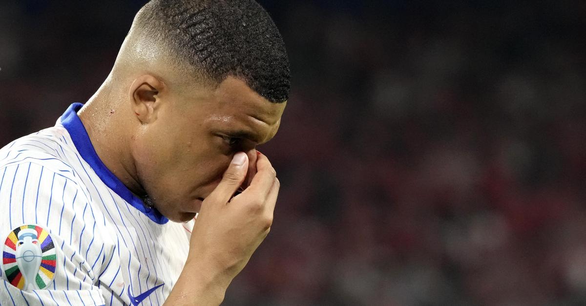 Nasenbeinbruch Nase Der Nation Kylian Mbappe Muss Unters Messer